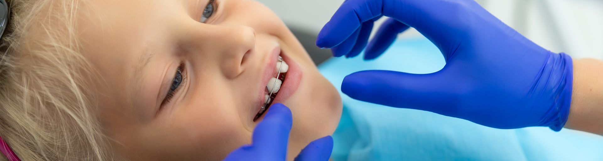 traitement orthodontie enfant Delavierre